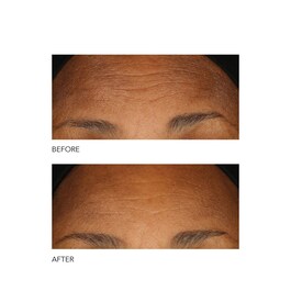 Alpha Beta® - Peeling Quotidien Formule Intense
