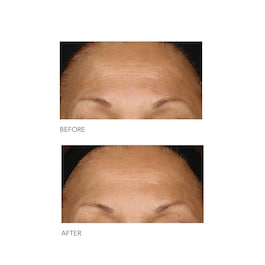 Alpha Beta® - Peeling Quotidien Formule Intense