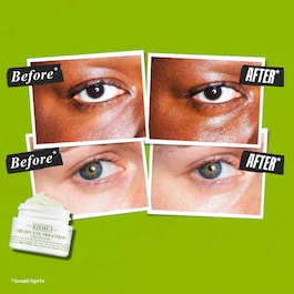 Crème Contour des Yeux à l’Avocat - Creamy Eye Treatment With Avocado