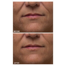 Alpha Beta® - Ultramildes Peeling für den Alltag