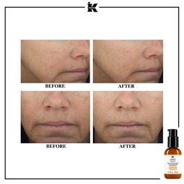 Powerful Strength Line Reducing Concentrate Serum - Sérum anti-âge concentré